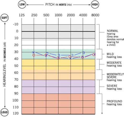 Degrees of Hearing Loss | Happy Ears Hearing Center