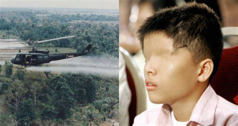 Agent Orange Victims Then And Now, In 24 Disturbing Photos