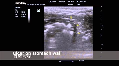 Ultrasound case study- dog with gastric ulcers - YouTube