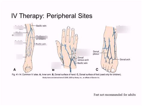 IV therapy and IV medication administration Diagram | Quizlet