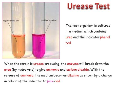 Urease Test Objective Principle Procedure And Result Online | Images and Photos finder