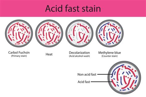 Principle and Procedure of Acid Fast Staining - Solution Parmacy