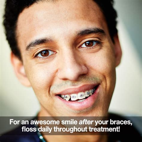 Some Important Tips For Flossing With Braces