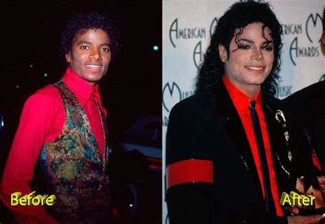 The Unforgettable Michael Jackson Before and After Plastic Surgery ...