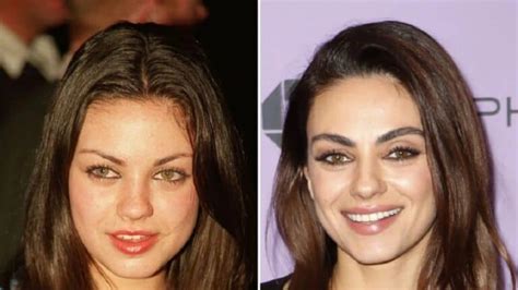 Did Mila Kunis Had Plastic Surgery On Cheetos Commercial? Before And ...