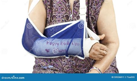 Elderly Woman With A Broken Arm On A Plaster Cast Stock Photo - Image ...