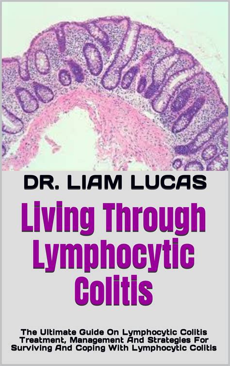 Living Through Lymphocytic Colitis: The Ultimate Guide On Lymphocytic Colitis Treatment ...