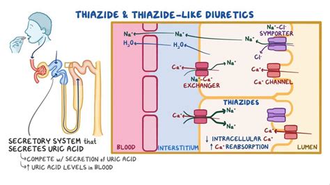 Thiazide and thiazide-like diuretics: Video, Causes, & Meaning | Osmosis