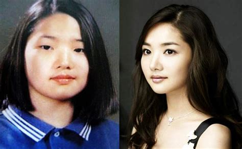 Park Min-young's plastic surgery - Before and after photos