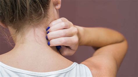 Beginning Stages Of Shingles On Neck