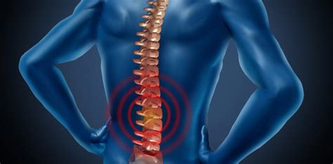 Chronic Back Pain Causes - Marietta Pain Doctor - Pain Management Atlanta