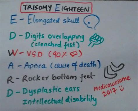 Medicowesome: Edward syndrome mnemonic