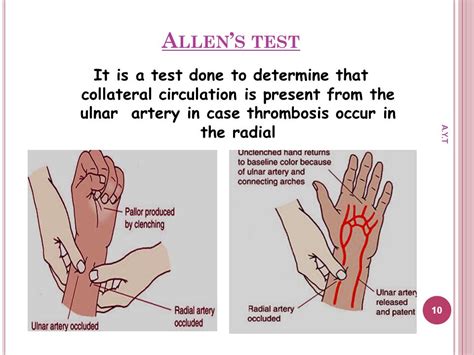 MEDICINE: Allen test part 7