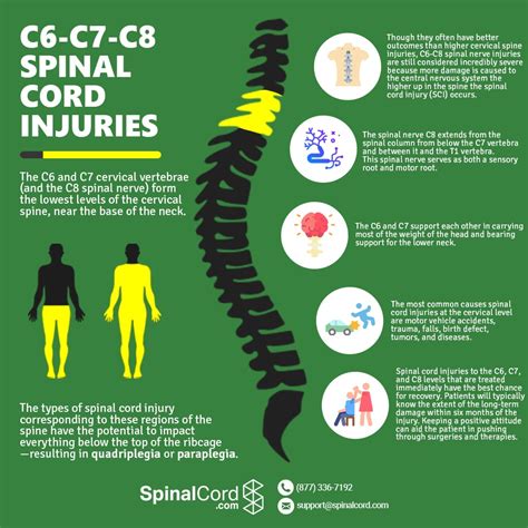 Cervical Spine | C6, C7, C8 Vertebrae | Spinal Cord Injury | Fracture