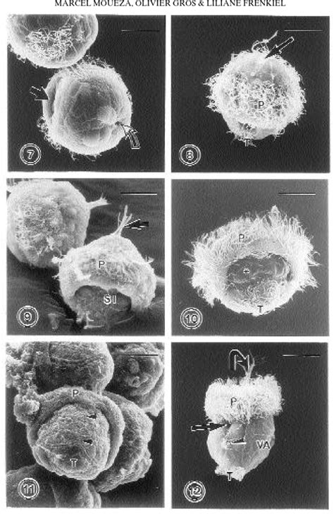 Later trochophore at T 0 ϩ 12 h; postero lateral view to show the... | Download Scientific Diagram