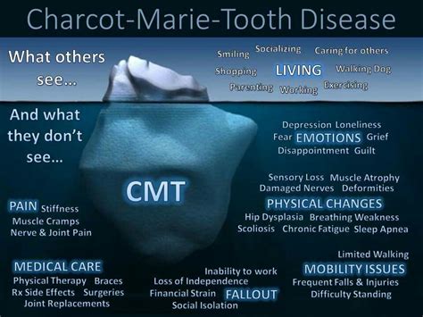 This is the disease my son has. Charcot Marie Tooth disorder we will ...