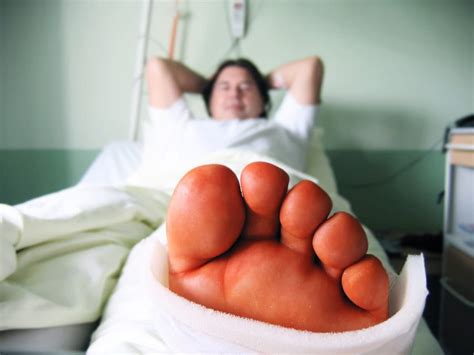 Foot Surgery Types And Recovery | Marietta Foot Doctor Learn More Now!