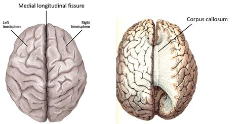 Cerebrum - Exam Questions - Anatomy QA