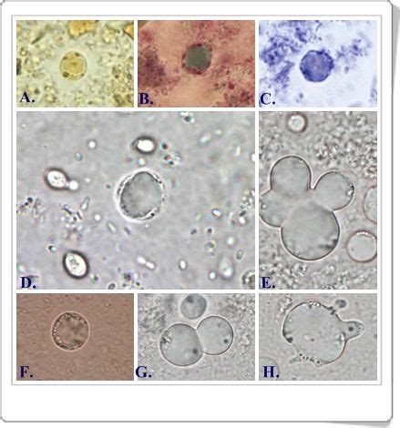 Blastocystis hominis | Medical laboratory scientist, Medical laboratory, Microbiology