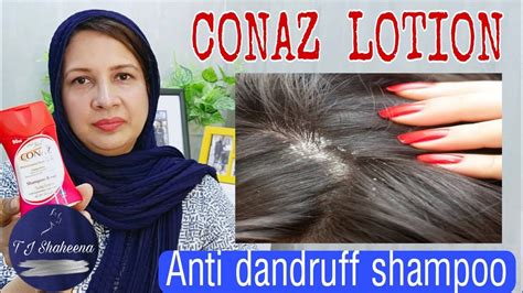 Best ANTI-DANDRUFF treatment|| How to use CONAZ shampoo || Affordable ...