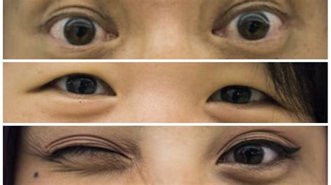 13 Asians On Identity And The Struggle Of Loving Their Eyes | HuffPost Australia Life