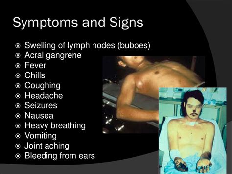 Bubonic Plague Symptoms Buboes