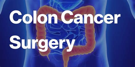 Colon Cancer Surgery: What Foods Should I Avoid? - Better Health Cares ...