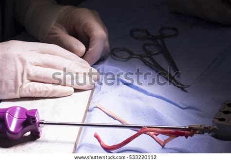 Knee Tendon Ligament Repair Surgery Hospital Stock Photo 533220112 | Shutterstock