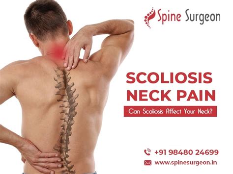 Scoliosis Neck Pain: Can Scoliosis affect your Neck? | Spine Surgeon