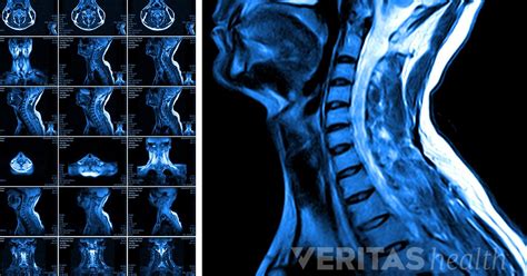 Do I Need an MRI Scan?