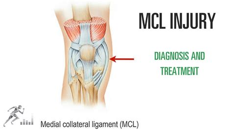 Mcl Anatomy - Anatomical Charts & Posters