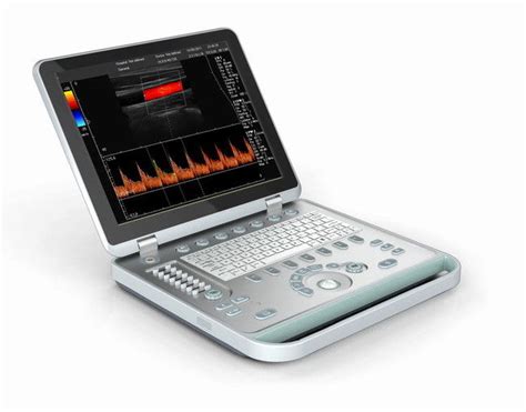 Light Portable 3D Handheld Doppler Ultrasound Machine With 15" LED Screen