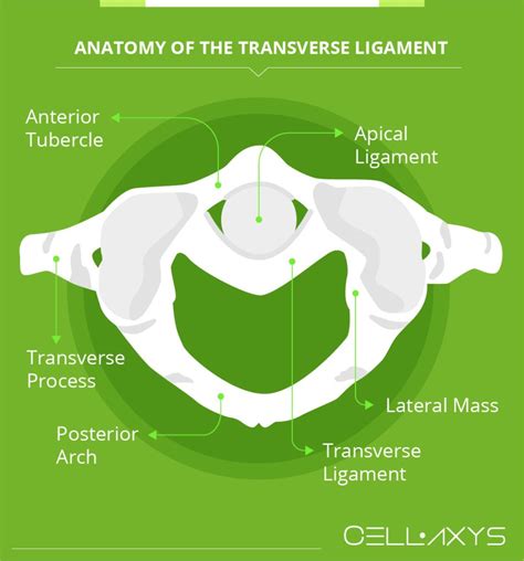 Transverse Ligament – An Update In Diagnosing And Treating Cervical ...