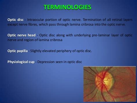 Optic disc evaluation