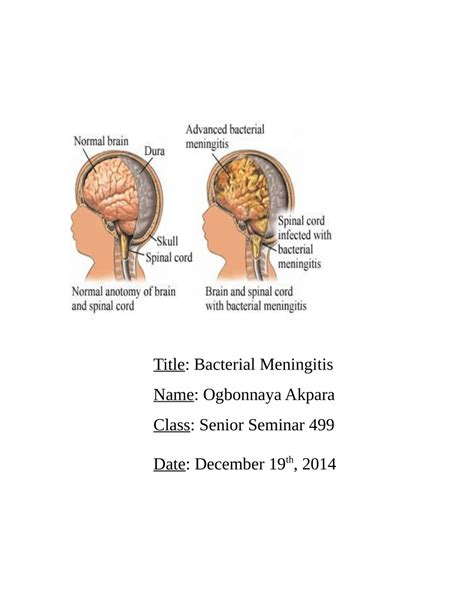 (PDF) Bacterial Meningitis by Ogbonnaya Akpara