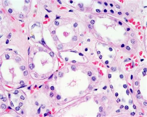 Renal Pyramid Histology