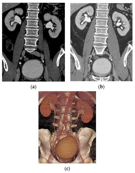 Multidetector CT Urography: Techniques, Clinical, 60% OFF