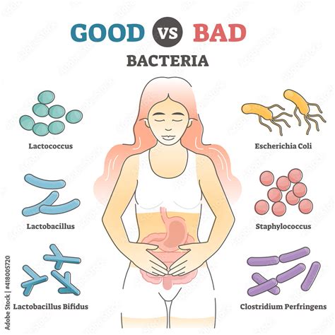 Good vs bad bacteria as gut flora examples in educational outline diagram Stock Vector | Adobe Stock