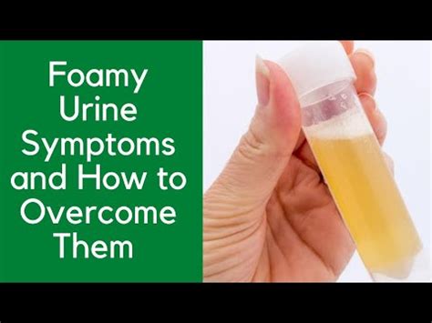 Foamy Urine Symptoms and How to Overcome Them - YouTube