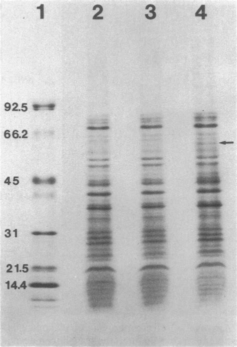 Sodium dodecyl sulfate-polyacrylamide gel electrophoresis of membrane ...