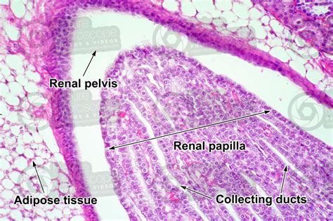 Renal Papillae