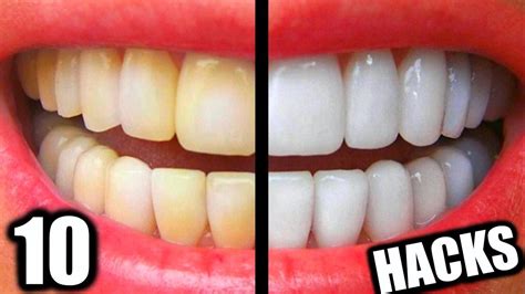 diy whitening strips for teeth - Karma Tuck