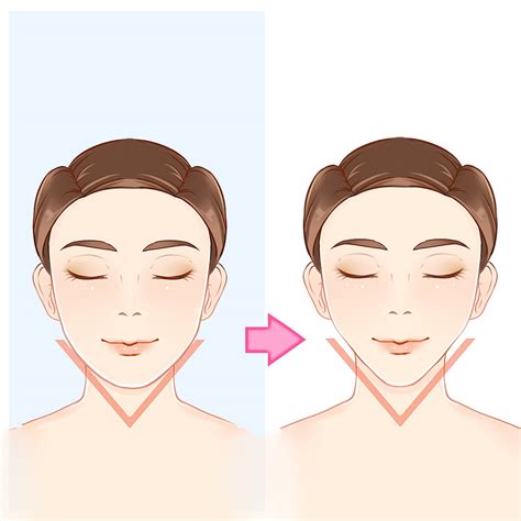 Can I Get a V-Shape Face Without Surgery? Answered by Beverly Wilshire Medical Centre | Erufu Care