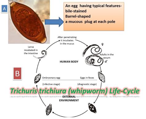 Trichuris Trichiura: Introduction, Morphology, Life Cycle, Mode Of Infection | vlr.eng.br