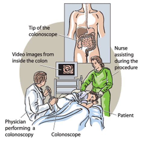 Colonoscopy - MedBroadcast.com