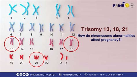 Trisomy 13, 18, 21! How do chromosome abnormalities affect pregnancy?!