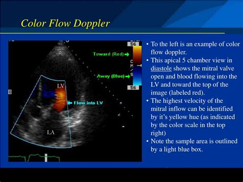 PPT - Basic Echocardiography Modes and Modalities PowerPoint ...