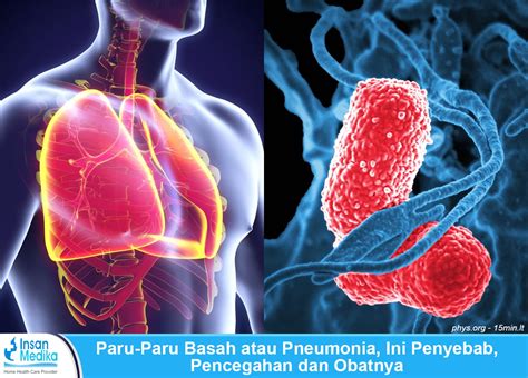 Paru-Paru Basah (Pneumonia): Penyebab, Jenis, Gejala dan Pengobatan