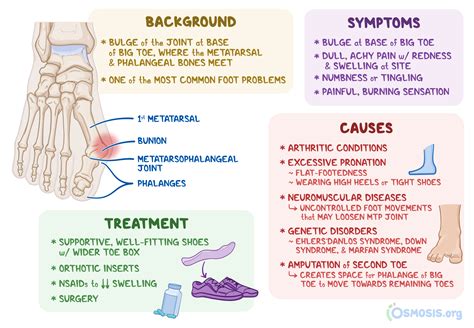 Bunion: What Is It, Causes, Treatment, and More | Osmosis