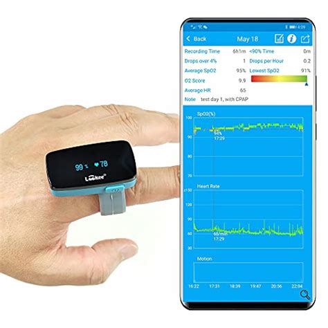 Best Continuous Pulse Oximeter With Alarm Overnight 2024 Where to Buy? PulseOx.net